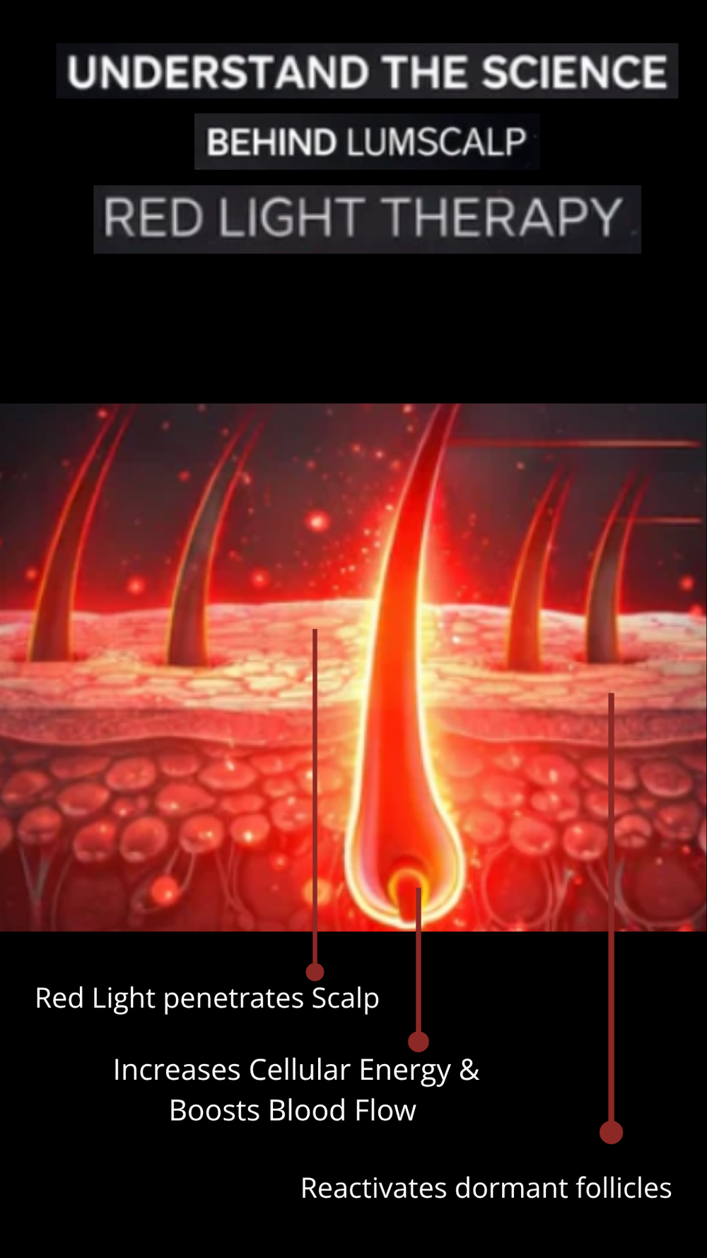 LumiScalp - Red Light Therapy Cap For Scalp