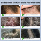 LumiGrow Camera Scalp Analyzer & Liquid Applicator Comb | 30W Pixel HD Camera 20X Magnification