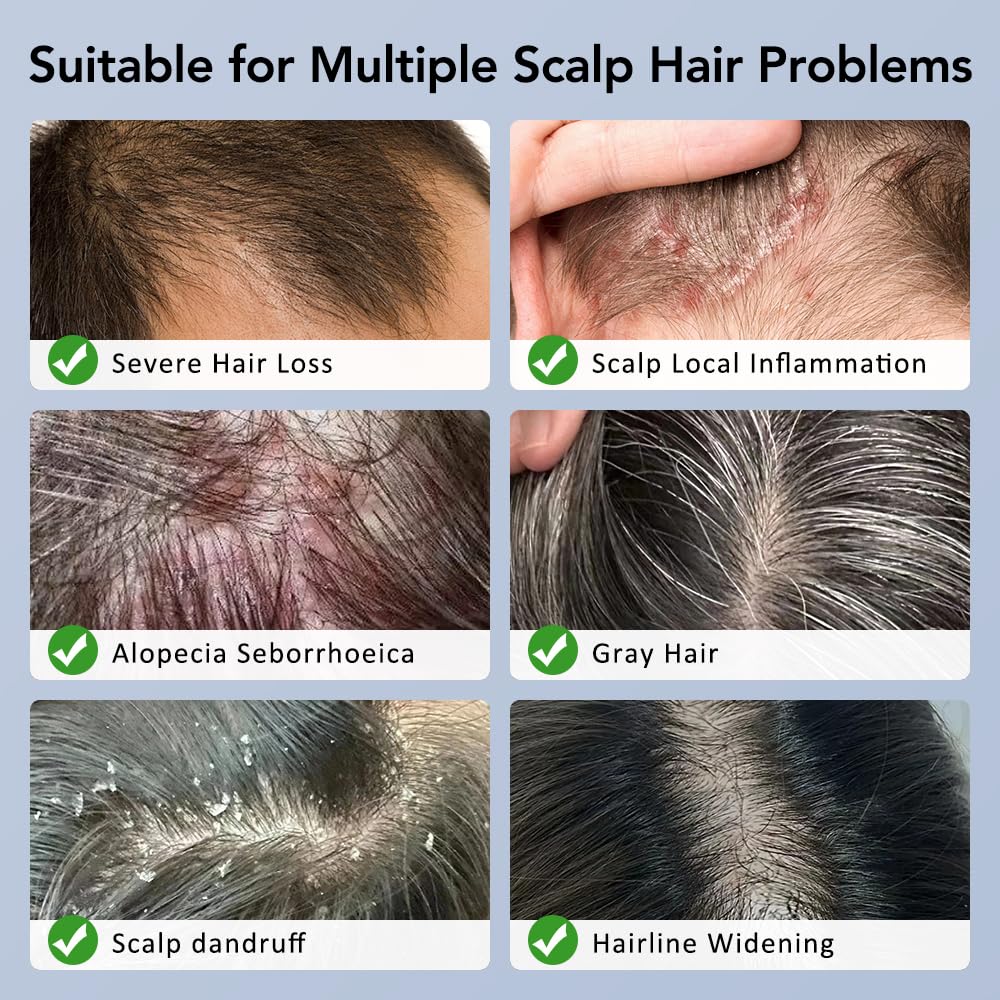 LumiGrow Camera Scalp Analyzer & Liquid Applicator Comb | 30W Pixel HD Camera 20X Magnification