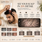 LumiGrow HD Scalp Analyzer & Serum Applicator Comb with 20X Camera, Red Light Therapy & Microcurrent Stimulation
