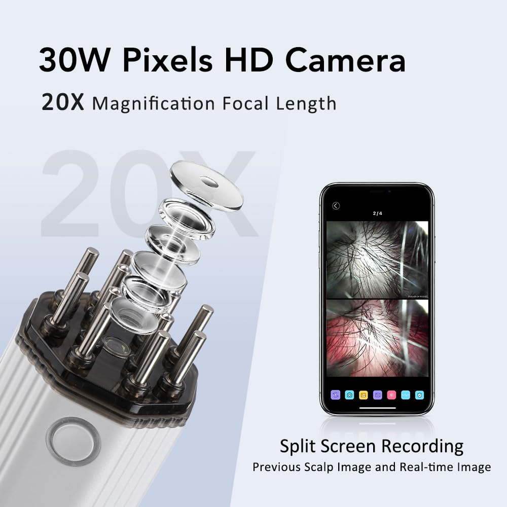 LumiGrow Camera Scalp Analyzer & Liquid Applicator Comb | 30W Pixel HD Camera 20X Magnification
