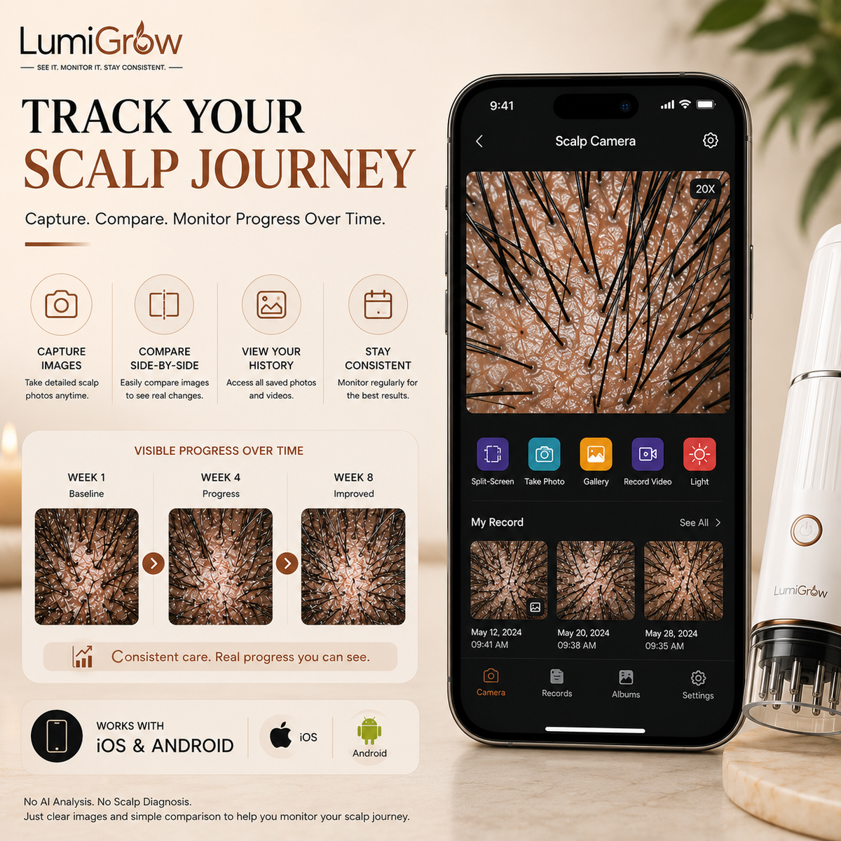 LumiGrow HD Scalp Analyzer & Serum Applicator Comb with 20X Camera, Red Light Therapy & Microcurrent Stimulation