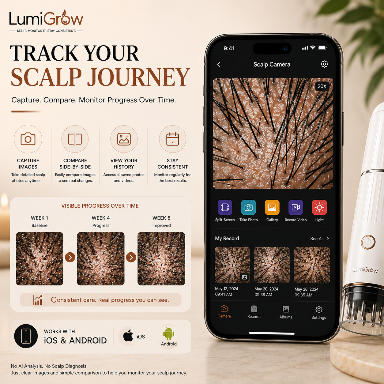 LumiGrow HD Scalp Analyzer & Serum Applicator Comb with 20X Camera, Red Light Therapy & Microcurrent Stimulation