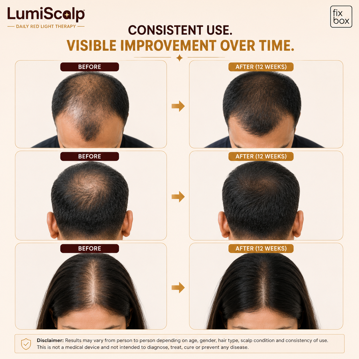 LumiScalp Red Light Therapy Cap for Hair Growth