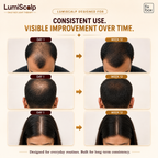 LumiScalp Red Light Therapy Cap for Hair Growth