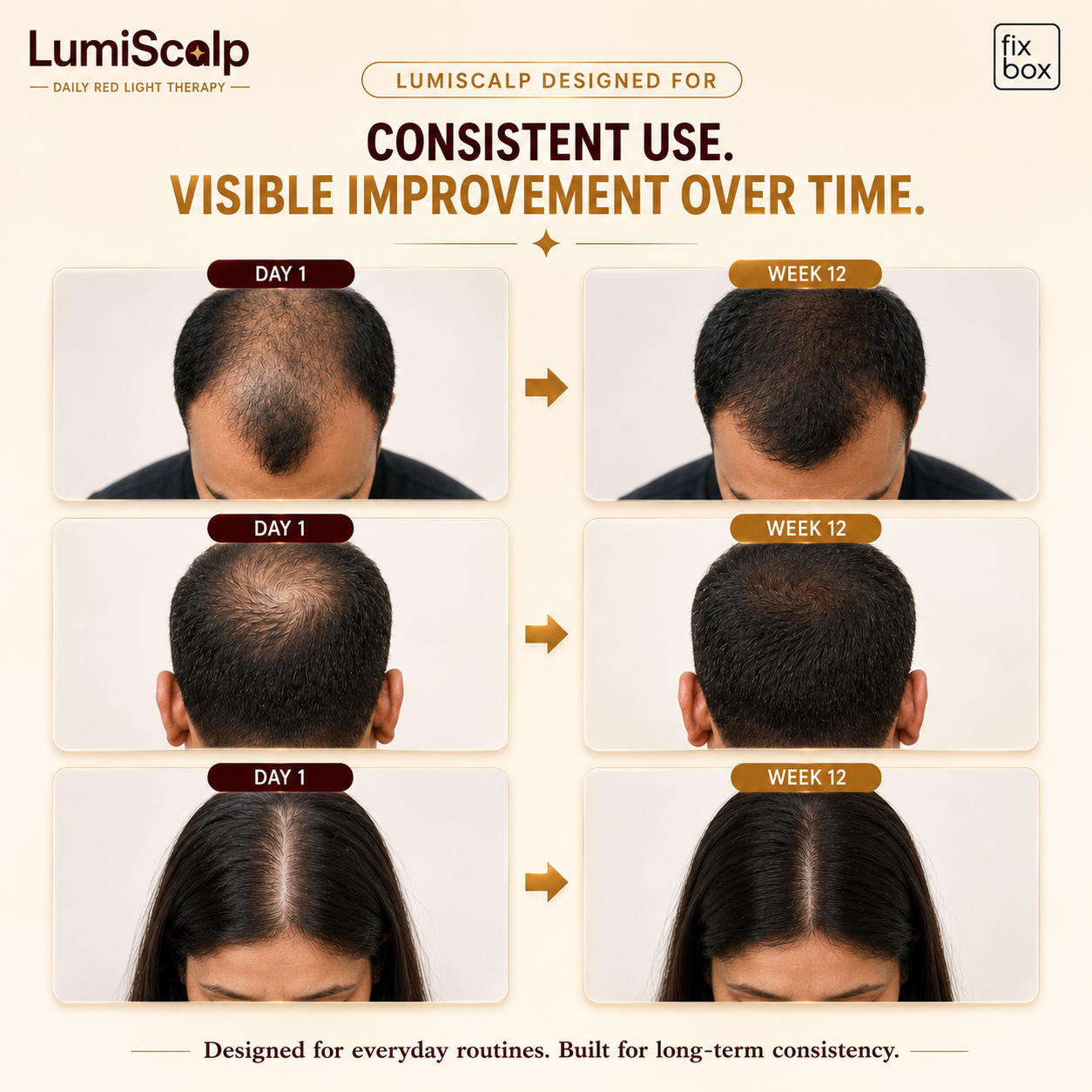 LumiScalp Red Light Therapy Cap for Hair Growth