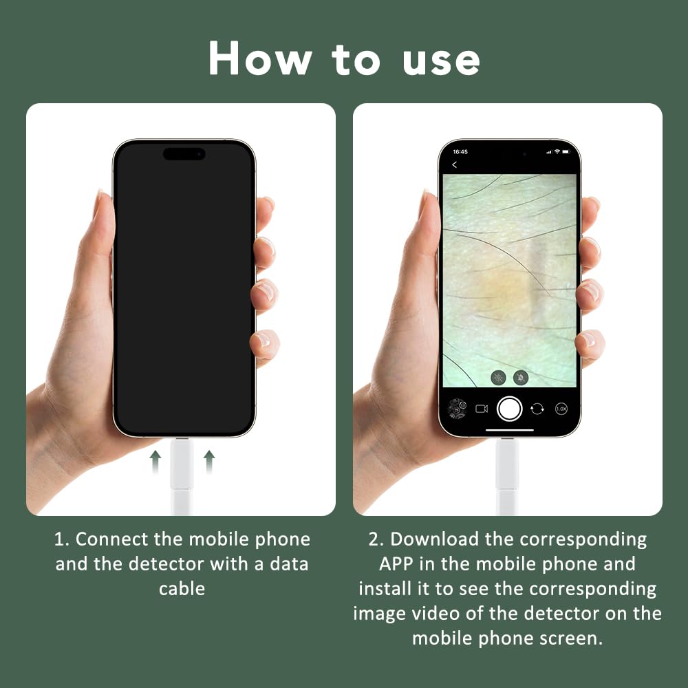 LumiScope Scalp & Skin Analyzer | 4X Magnification HD Camera