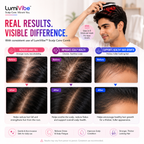 FixBox LumiVibe Red & Blue Light Therapy Scalp Massager Comb