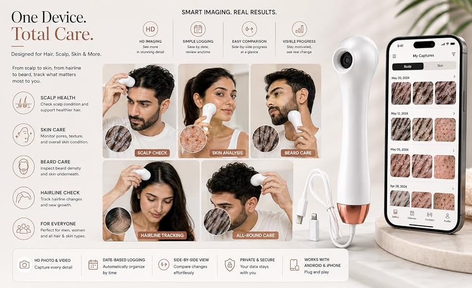 LumiScope Scalp, Hair & Skin Analyzer | 4X Magnification HD Camera details