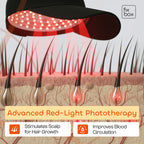 LumiScalp - Red Light Therapy For Scalp